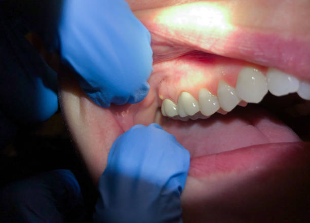 Best Same-Day Emergency Dental Services in Oakwood, GA