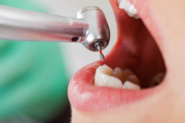 Best Emergency Treatment for Dental Infections or Abscesses in Oakwood, GA